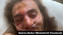 Georgian civil activist Zuka Berdzenishvilli recovers after he said he was attacked on June 11.