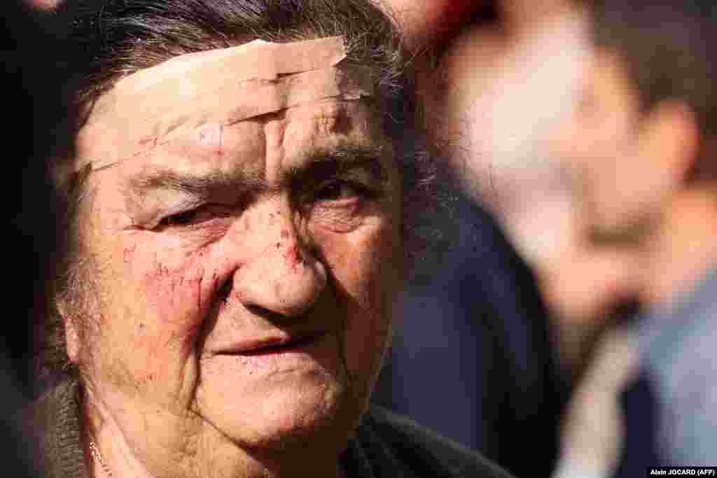 An elderly woman with a head wound waits to be registered as a refugee in Goris on September 27. The family was involved in a car accident as they were fleeing from Nagorno-Karabakh. A total of 192 Azerbaijani troops were killed and 511 were wounded during Azerbaijan&rsquo;s offensive last week&nbsp;the country&rsquo;s Health Ministry announced on September 27. Ethnic Armenian Nagorno-Karabakh officials said that at least 200 people on their side, including 10 civilians, were killed and over 400 were wounded in the fighting.