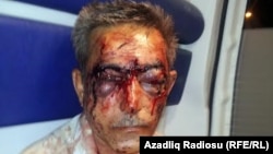 Azerbaijani journalist İlgar Nasibov suffered severe head trauma, a broken nose, fractured ribs, and serious blood loss.