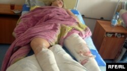 One of the injured in the Minsk explosion