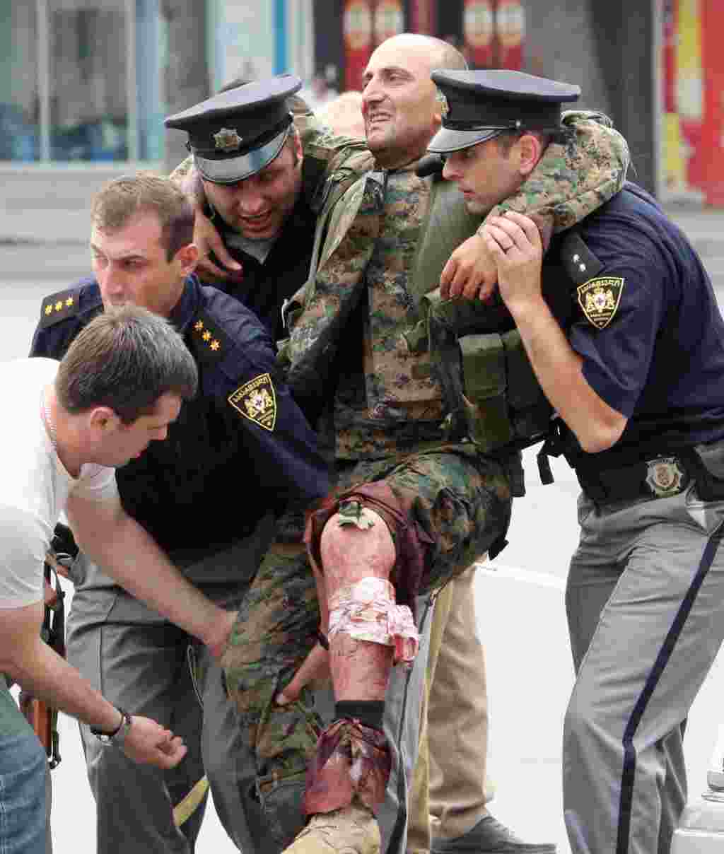 Police officers help a Georgian soldier who was wounded in fighting with South Ossetian separatists in the town of Gori.