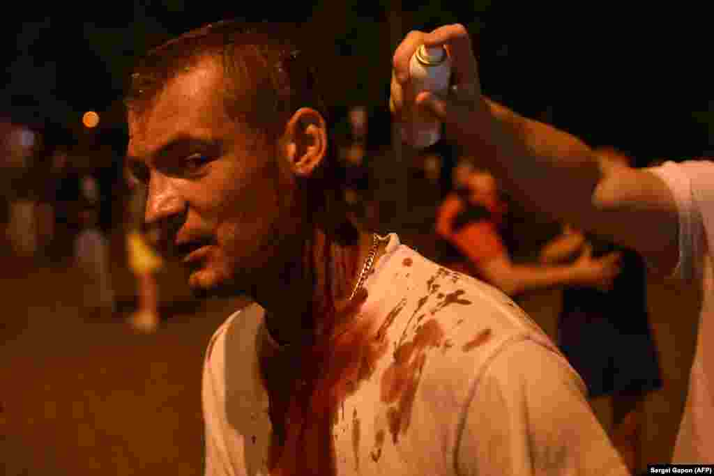 An injured man receiving help during a rally of opposition supporters.