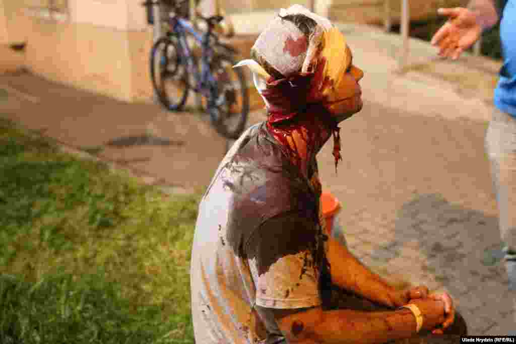 Another badly bloodied protester in Minsk on the night of August 10.