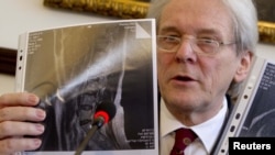 Karl Einhaeupl of the Charite Hospital displays two magnetic resonance tomography images of the spine of Yulia Tymoshenko that show a spinal disc herniation during a news conference in Berlin on April 27.