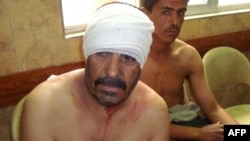 Men injured in the bombing sit bandaged in a Baghdad hospital.