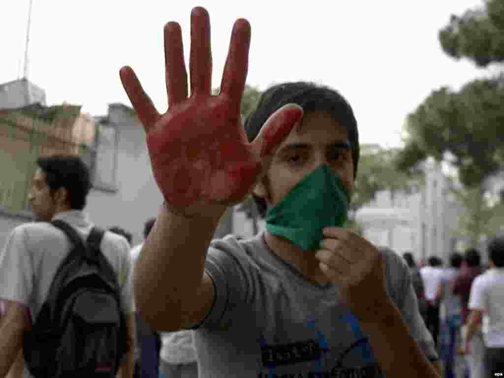 A protester shows a bloodied hand after the clashes. 