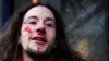 Russian Antigay Protest Turns Violent