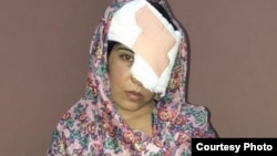 Salema Akhundzada endured 11 hours on poor roads before she and her mother arrived at Kabul's Emergency Hospital for treatment. The doctors there were unable to save her left eye.