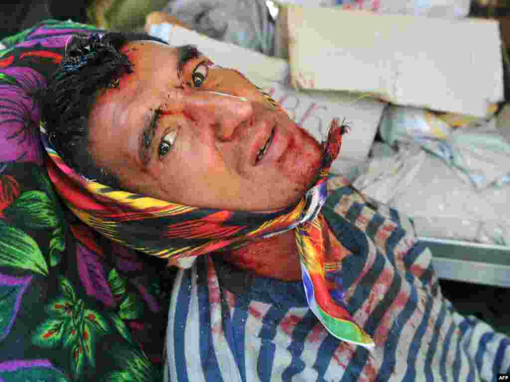 A man injured in the ethnic violence rests in an Uzbek neighborhood in Osh on June 14.