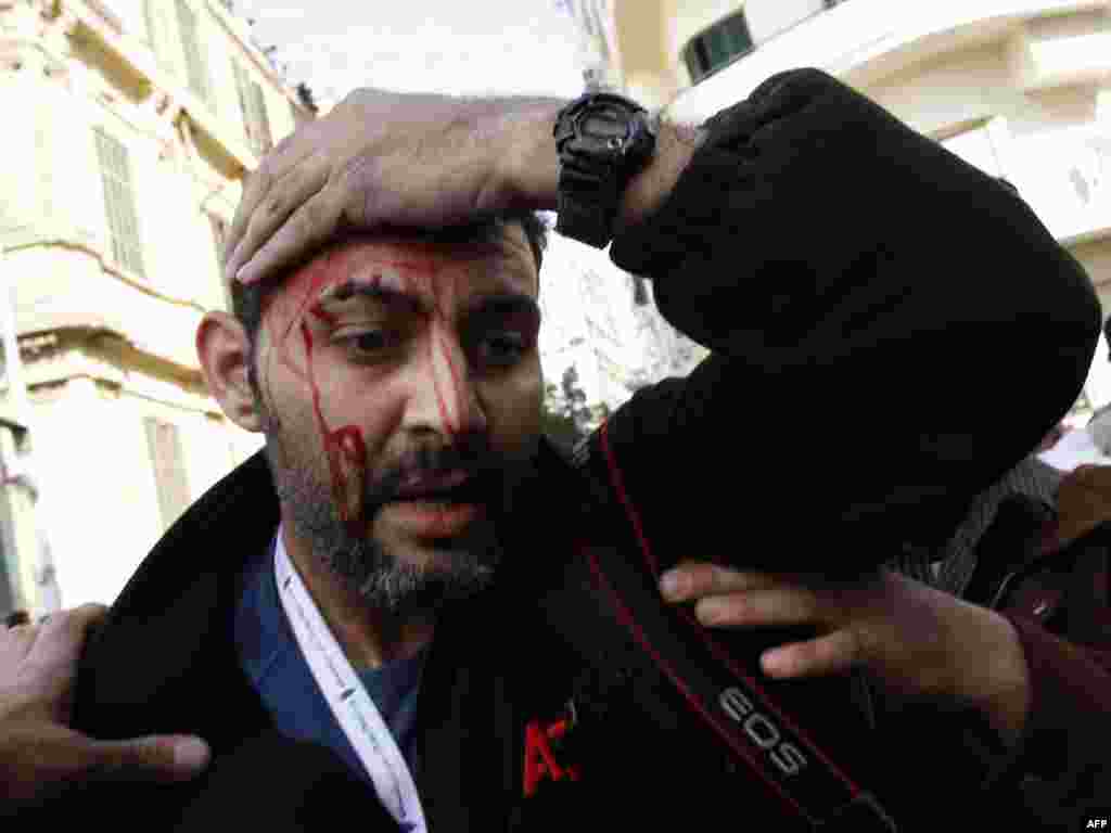 An AP news agency photographer is injured on Tahrir Square.