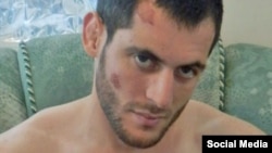 Murad Amriyev is shown in a photo from 2013, when he says he was kidnapped, beaten, and tortured by Chechen police.