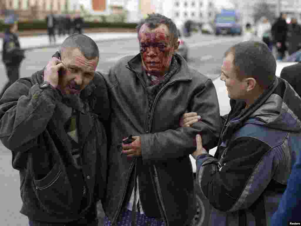 A badly injured man is led away for medical assistance.